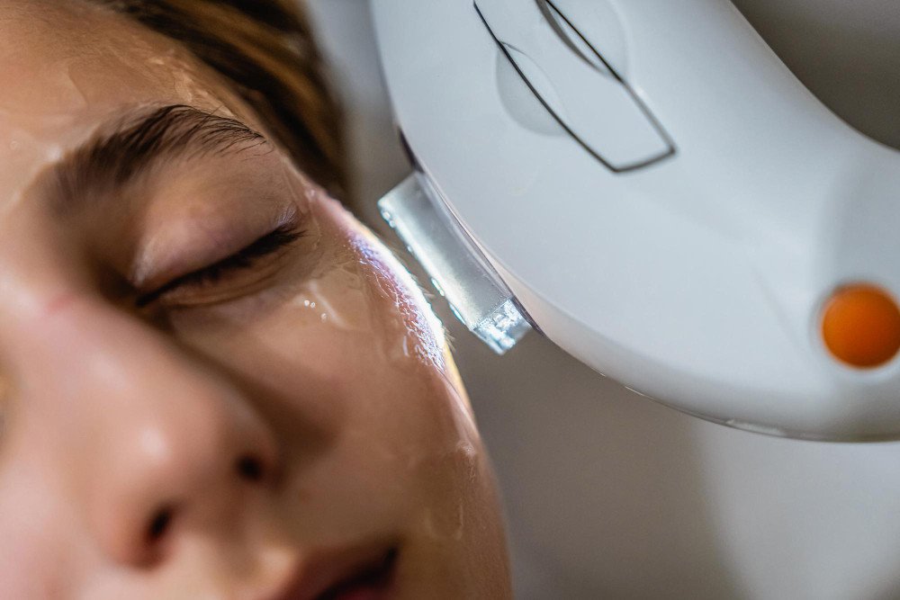 IPL Treatment in Bourbonnais, IL | Restore Clear, Youthful Skin